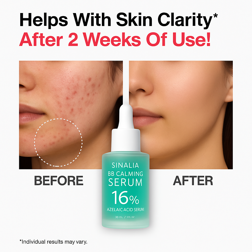 Sinalia Azelaic Acid 16% Calming Serum