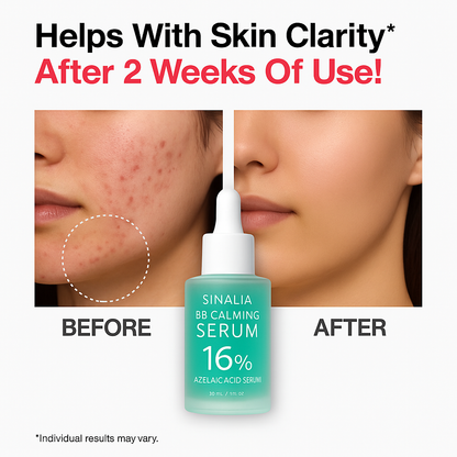 Sinalia Azelaic Acid 16% Calming Serum